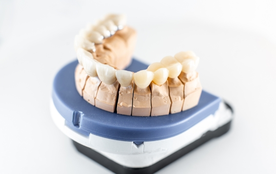 dental-imprint-with-artificial-teeth-2021-09-01-14-47-32-utc