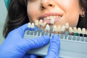 imagen de diferentes dientes simulando los tonos de blanqueamiento dental